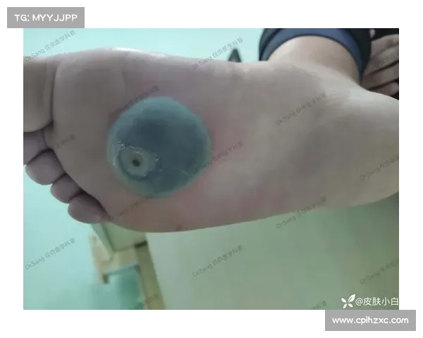 环法医疗报告揭示职业车手赛后恢复液氮冷冻疗法使用比例逐年上升 环法医疗报告揭示职业车手赛后恢复液氮冷冻疗法使用比例逐年上升